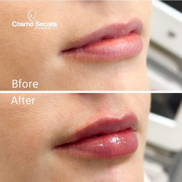 imageye___-_imgi_31_469856932_17989104404764995_1710797296610978672_n