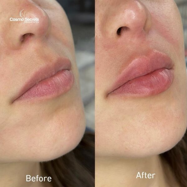 imageye___-_imgi_48_469863720_17989098602764995_6853902447136547267_n